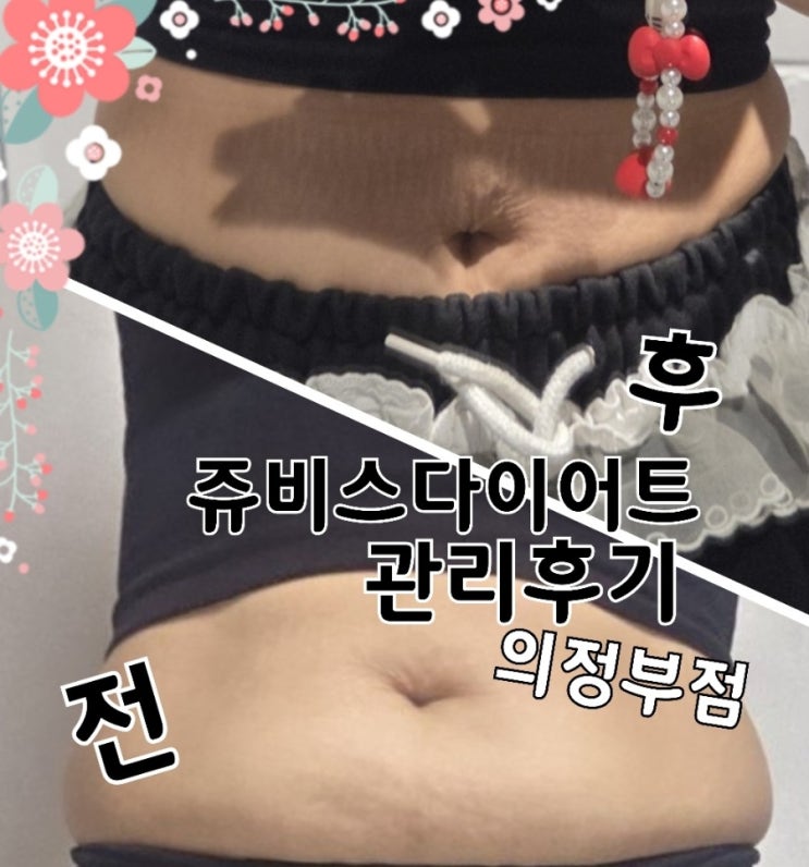  윤정수다이어트 쥬비스 의정부점 후기｜ 관리 후 느낀 솔직 변화