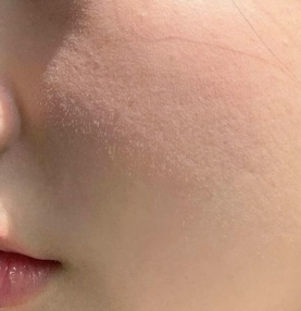 솜털 제거 하나로 얼태기 탈출, 나만의 비법 공유