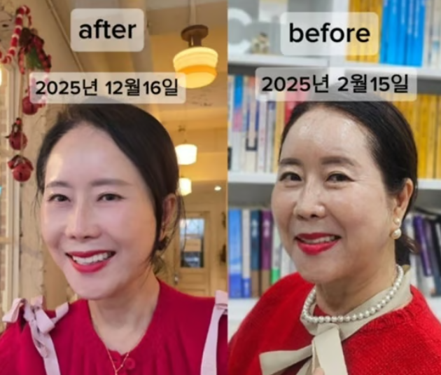 60대 윤영미 아나운서 9kg 감량 후 안면거상까지