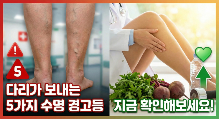  "원장님, 다리가 예전 같지 않아요..." 다리가 보내는 수명 경고등 5가지   (의사작성)