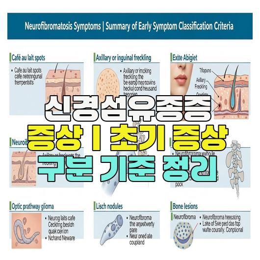  신경섬유종증 증상｜초기 증상 구분 기준 정리