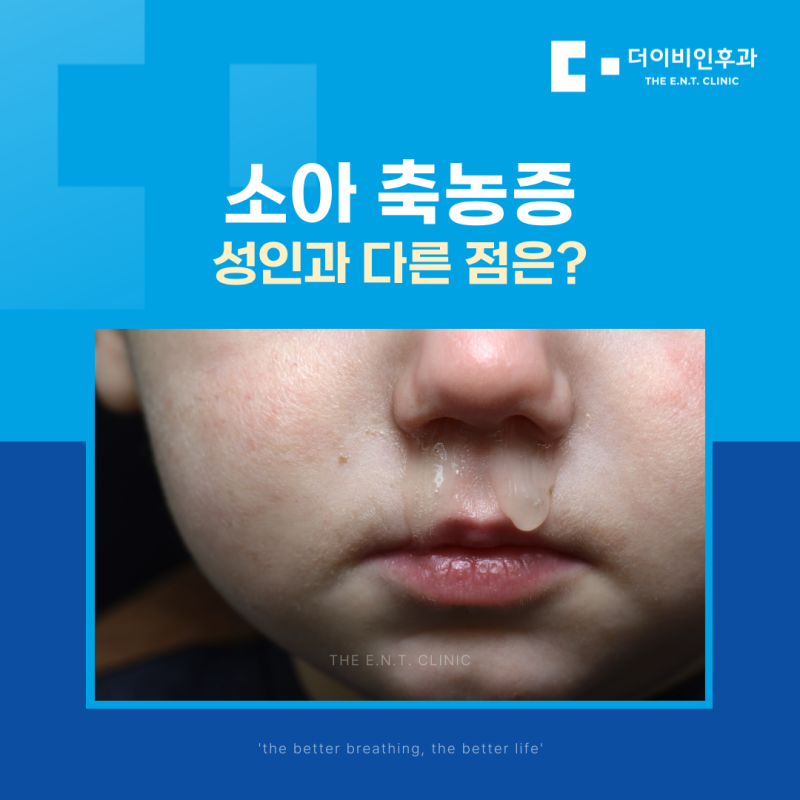 소아 축농증 성인과 다른 점은?