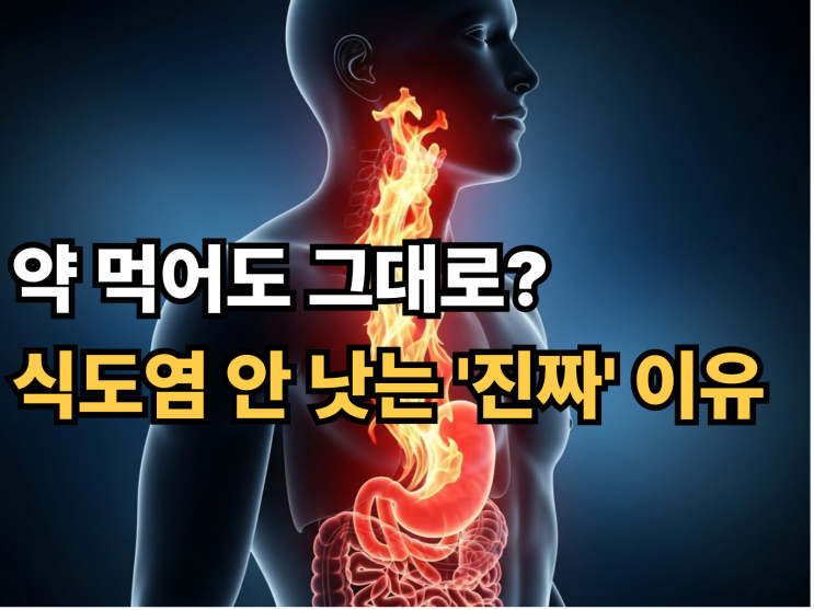  "약 먹어도 그때뿐..." 역류성 식도염, 절대 안 낫는 진짜 이유 3가지