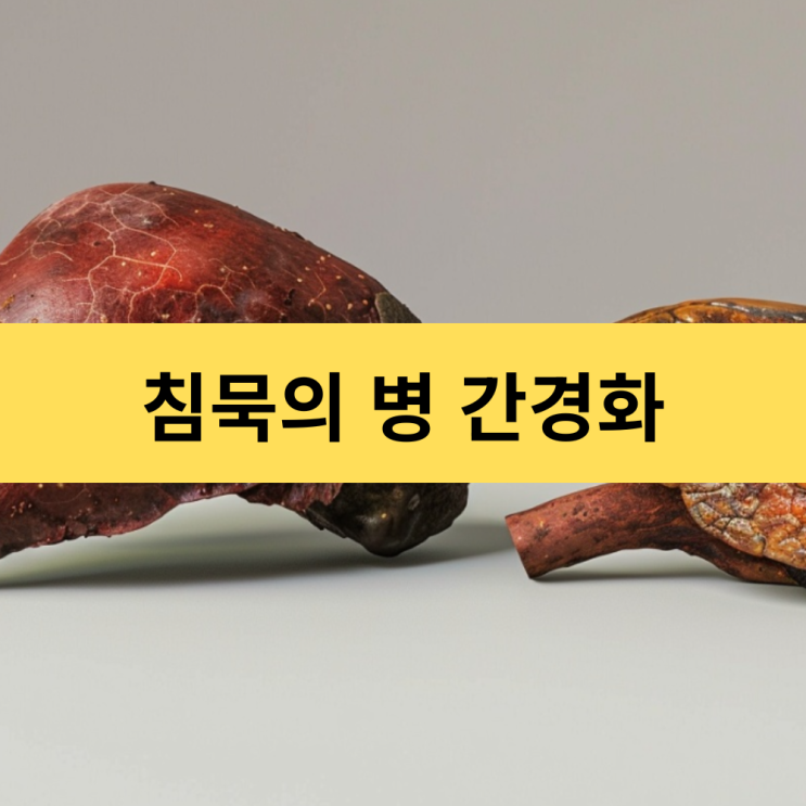  예술혼을 삼킨 침묵의 병 | 간경화의(간경변증) 진실