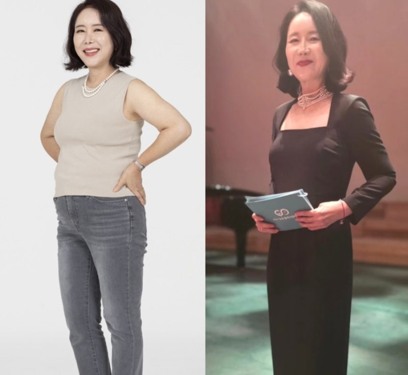 63세 윤영미 아나운서의 인생 변신... 9kg 감량하고 안면·목거상 시술까지 솔직 고백