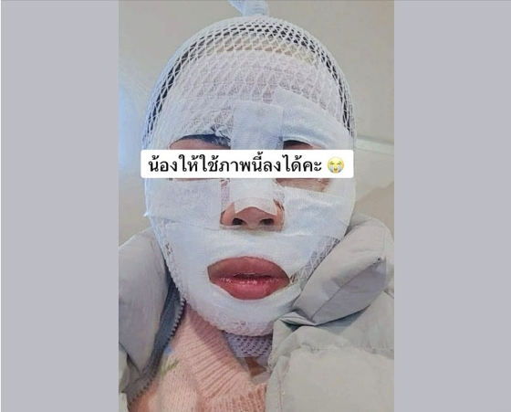 태국인 <b>아내 얼굴</b>에 <b>끓는 물</b> 부은 40대 남편, 끝내 구속