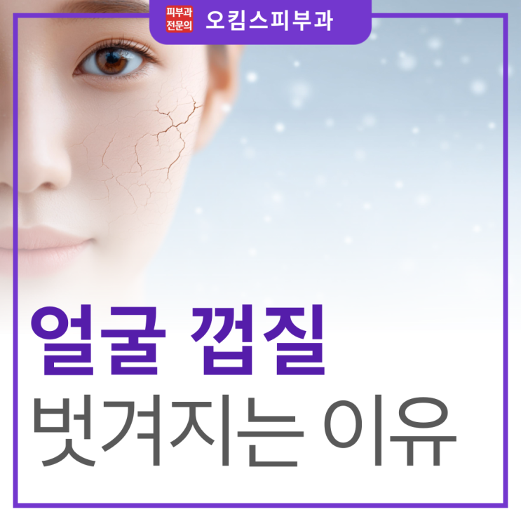  마두역 각질관리 피부과 겨울철 얼굴 껍질 벗겨짐, 반복되는 이유는?