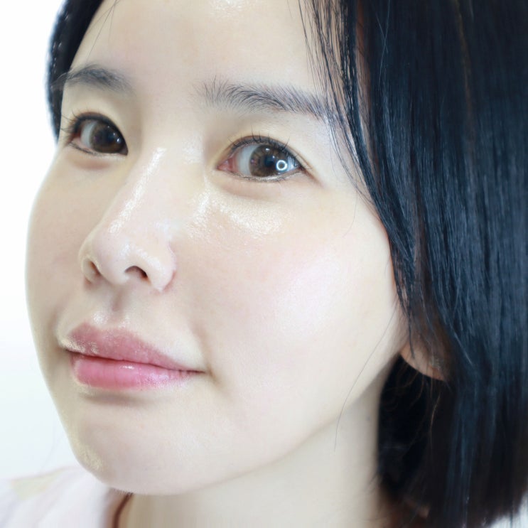  40대 피부탄력 끌올 부산 서면 세르프 리프팅 300샷 통증 없었던 후기