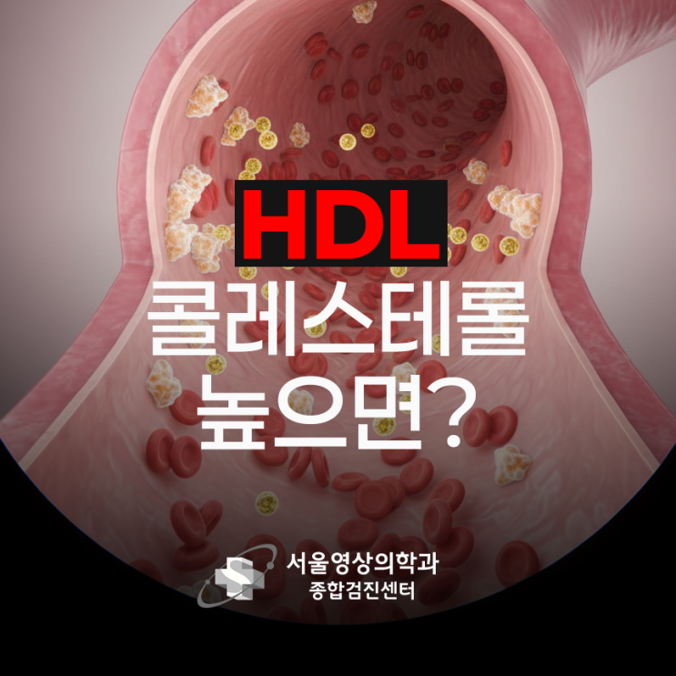  HDL 콜레스테롤 높으면 심혈관 질환 위험이 뚝 떨어집니다