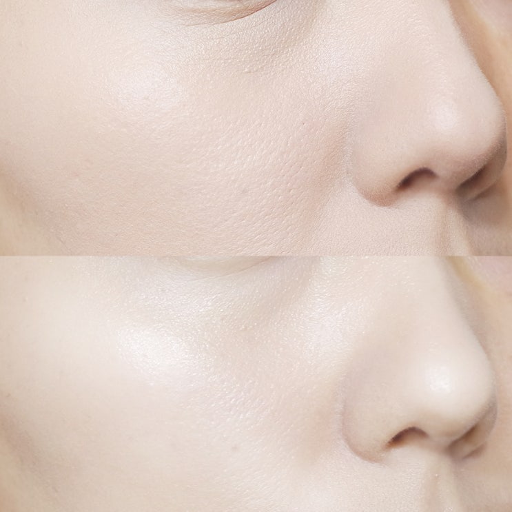  히알루론산 세럼 하나로 달라진 화잘먹 피부