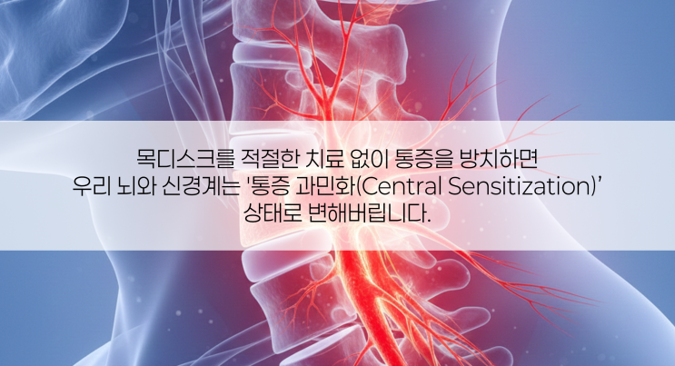  목디스크, '자연치유' 기다리다 신경 다 망가집니다