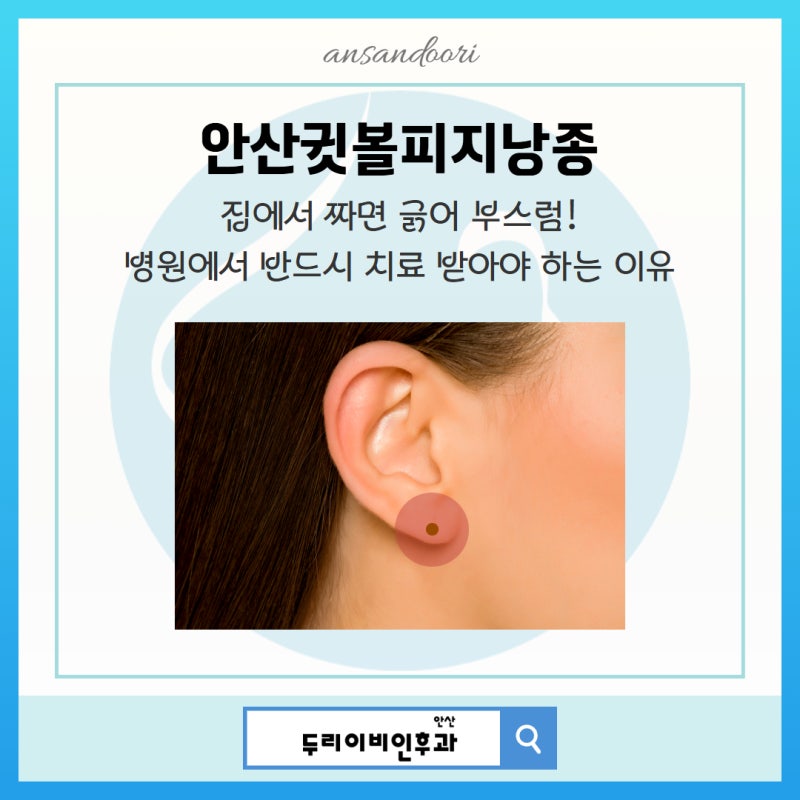 안산귓볼피지낭종 집에서 짜면 긁어 부스럼! 직접 짜면 안되는 이유 알아보기