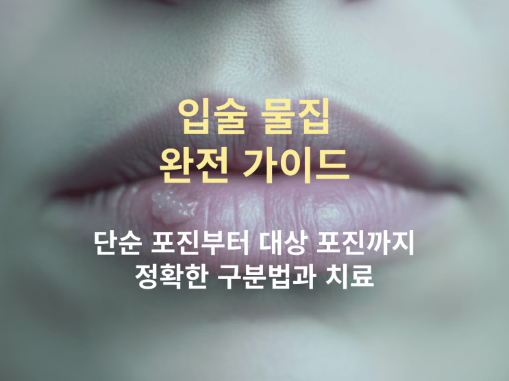  입술 물집 원인부터 치료·예방까지: 단순 포진과 대상 포진 구분법