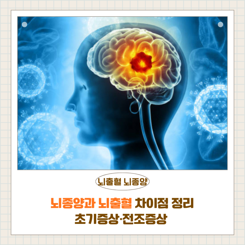 뇌종양과 뇌출혈 차이점 총정리｜초기증상·전조증상 한눈에 비교