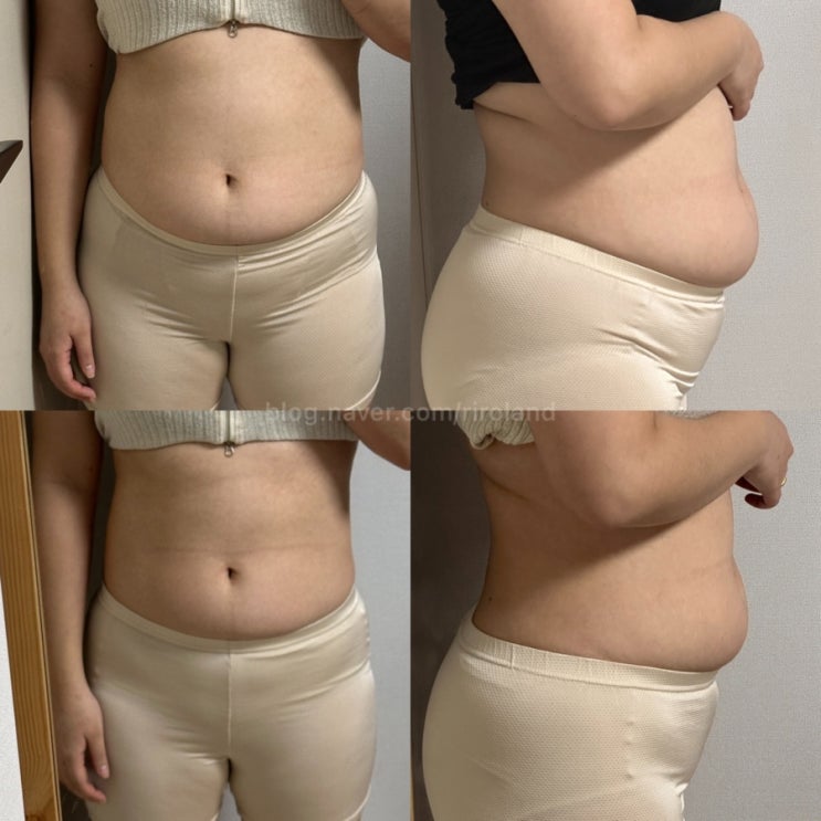  내돈내산 티알미, 혈당관리 & 붓기 & 체중조절에 도움되는 에이지락 TRME 90일 패키지 다이어트 찐 후기