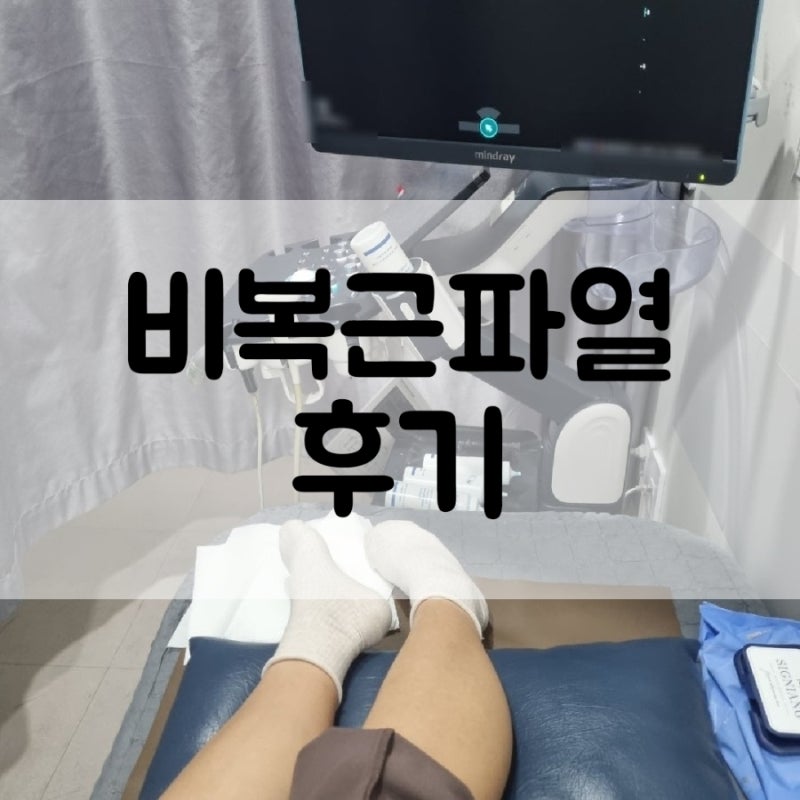 비복근파열 테니스레그 후기 | 회복 후 다시 러닝 하기까지 소요시간 및 예방 방법