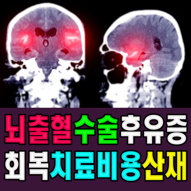 뇌출혈 수술(후유증, 회복기간, 치료비용) 산재보험 청구