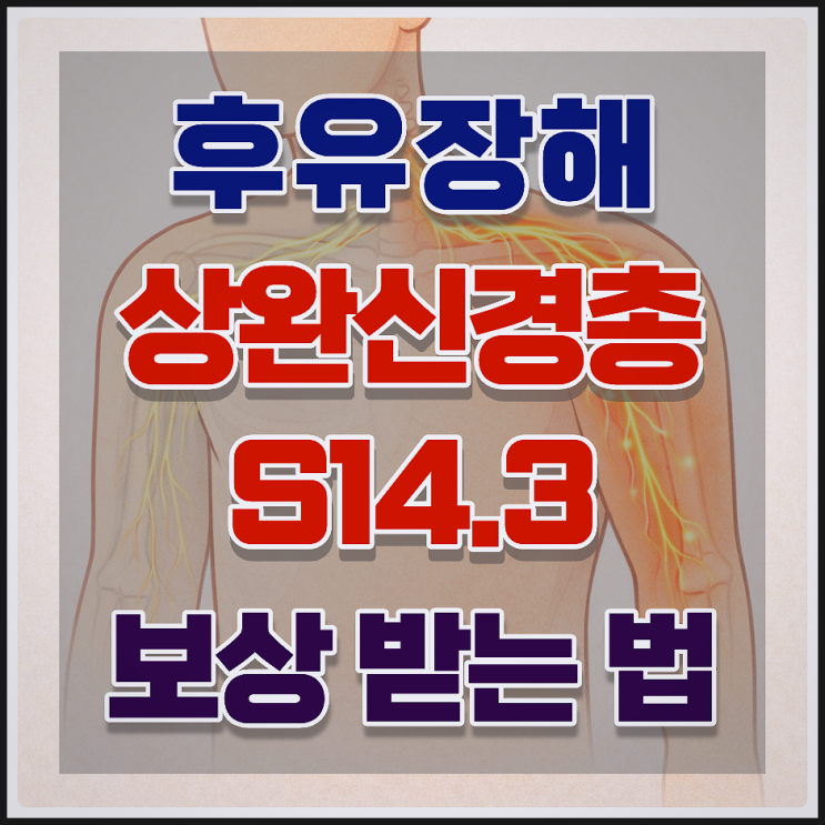  상완신경총 손상(Brachial Plexus), '후유장해' 보상의 핵심 (실제 사례)