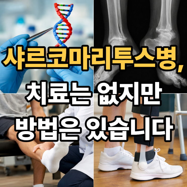  샤르코마리투스병 치료 가능할까? 현재 치료의 한계와 현실적인 관리 방법