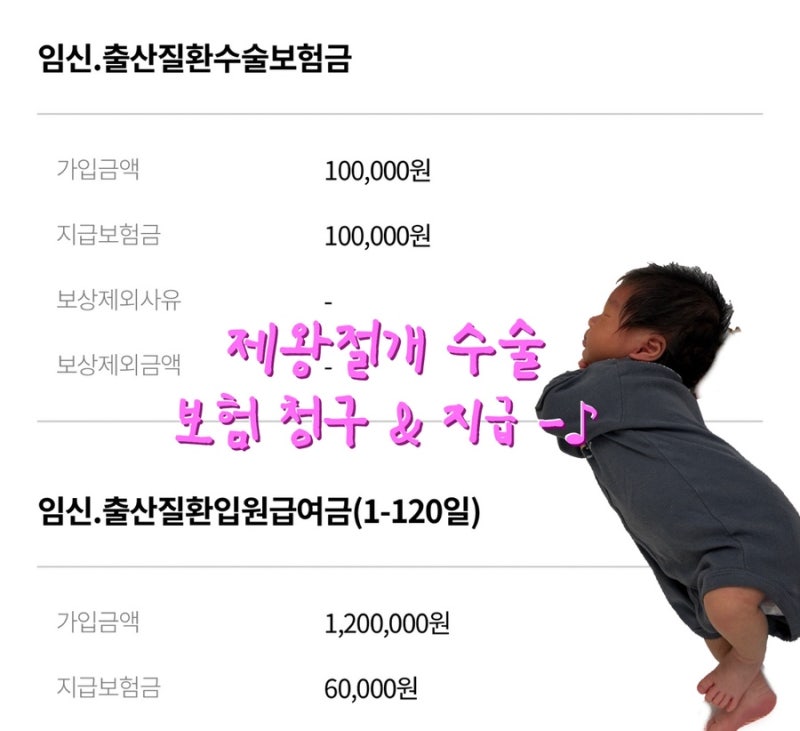 제왕절개 수술 & 입원비 청구 후기｜현대해상 산모특약 (태아보험)