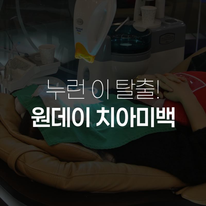 대구 원데이 치아미백 가격부터 사후관리 터치업까지