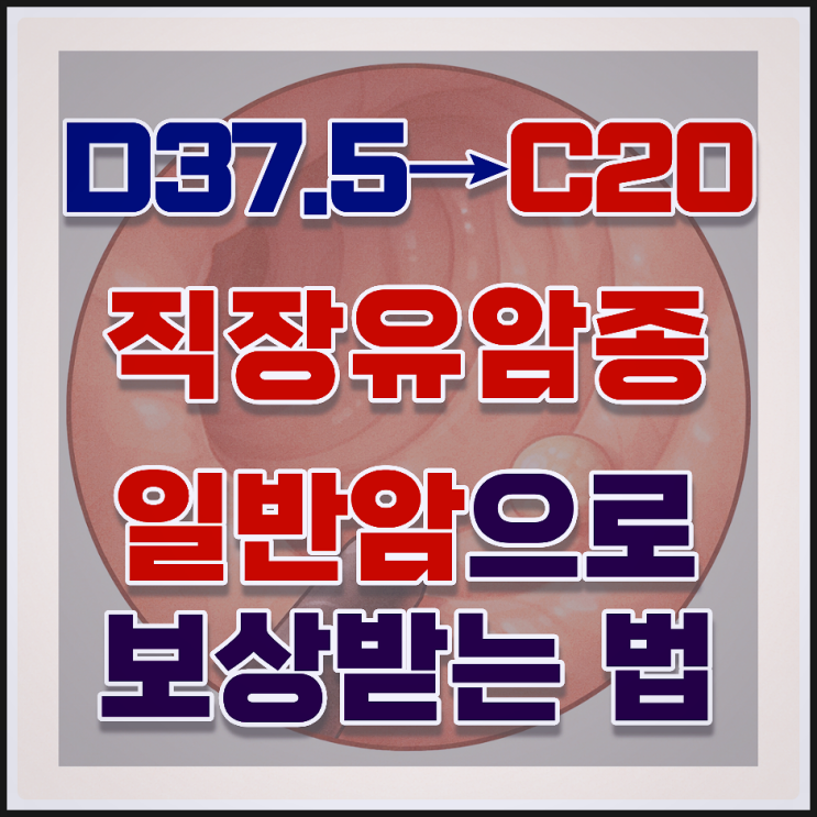  직장유암종(D37.5) 진단, C20 일반암 보상받는 '조직검사'의 비밀