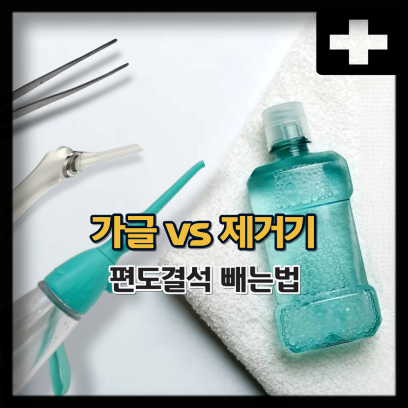 편도결석 빼는법 가글 vs 편도결석 제거기