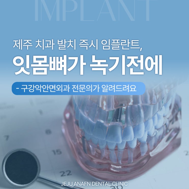  제주연동치과 잇몸 뼈 녹기 전에 심어야죠, 발치 즉시 임플란트