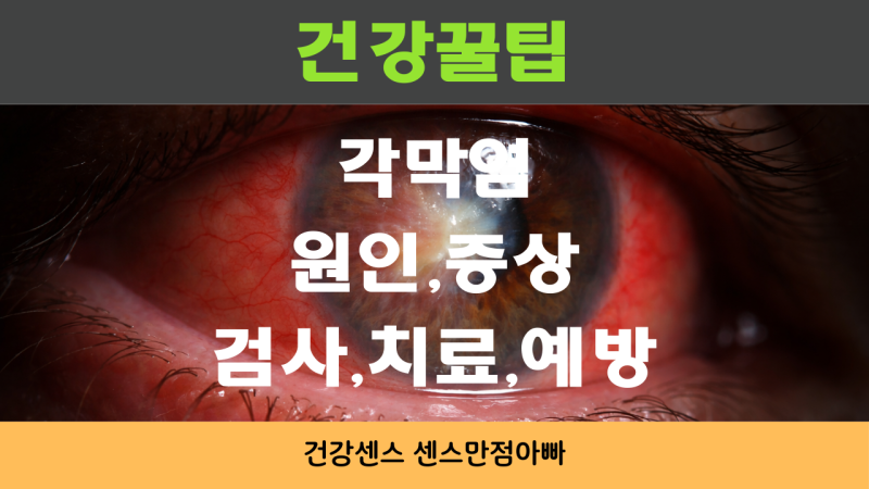 각막염이란? 원인, 증상, 검사, 치료, 예방 방법까지 정리