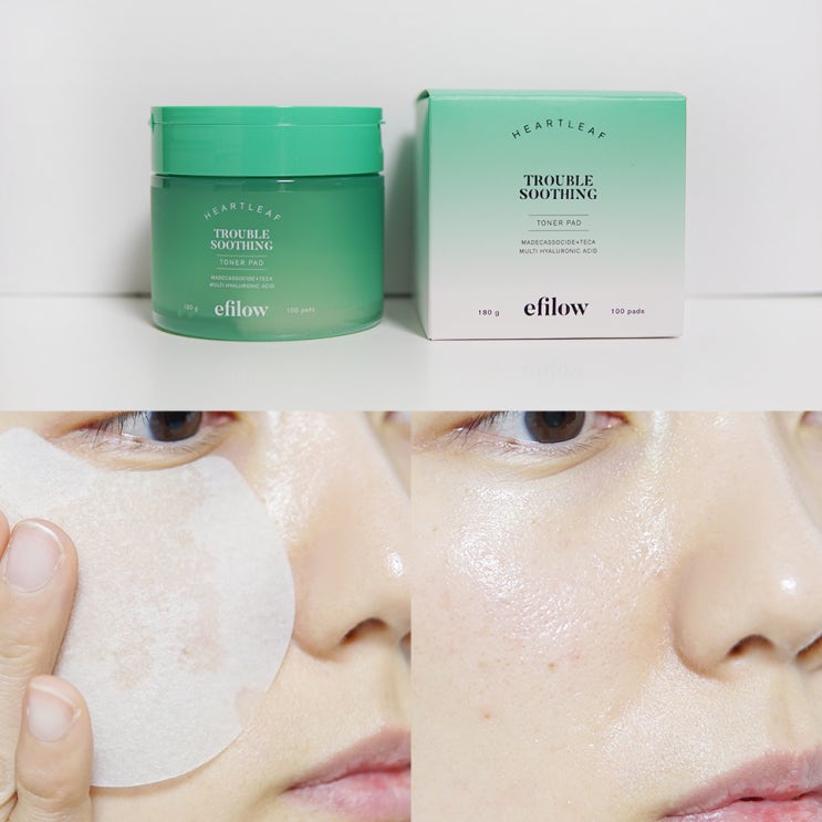  올리브영토너패드 추천 에필로우 마데카소사이드 토너패드로 좁쌀여드름 피부트러블 케어