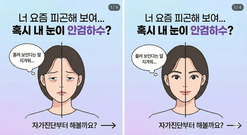 [대전 안과] "졸려 보인다는 말 자주 듣나요?" 안검하수 자가진단 및 수술 전 필수 체크리스트