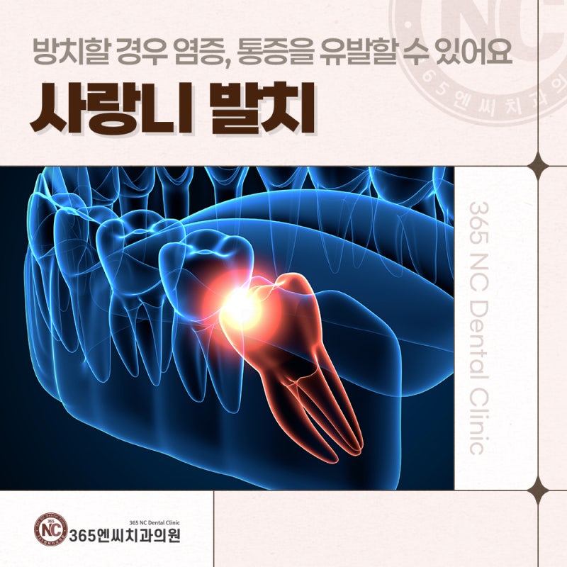 마산사랑니치과 발치 꼭 필요할까? 발치 전 고려 사항과 주의점