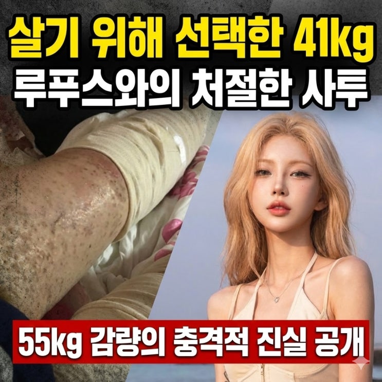 최준희(故최진실의 딸 )  55kg 감량의 진실: 루푸스 투병과 96kg 시절 '생존'을 위한 선택