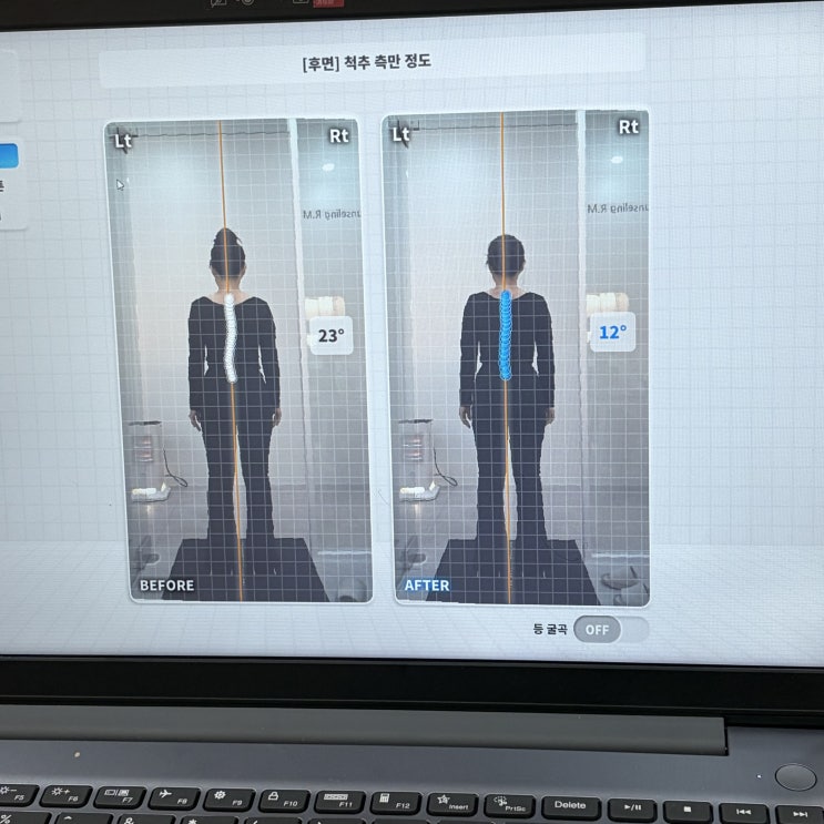  영등포시장 바디관리 스페이스뷰티 영등포시장점 척추측만 통증부터 종아리 뭉침까지 AI 정밀 케어 후기
