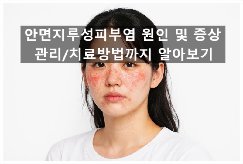 안면지루성피부염 원인 및 증상, 관리/치료방법까지 알아보기