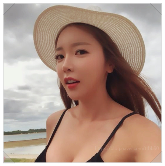  주사이모 불법 시술 논란 총정리 홍진영 연루설의 진실과 사건 구조