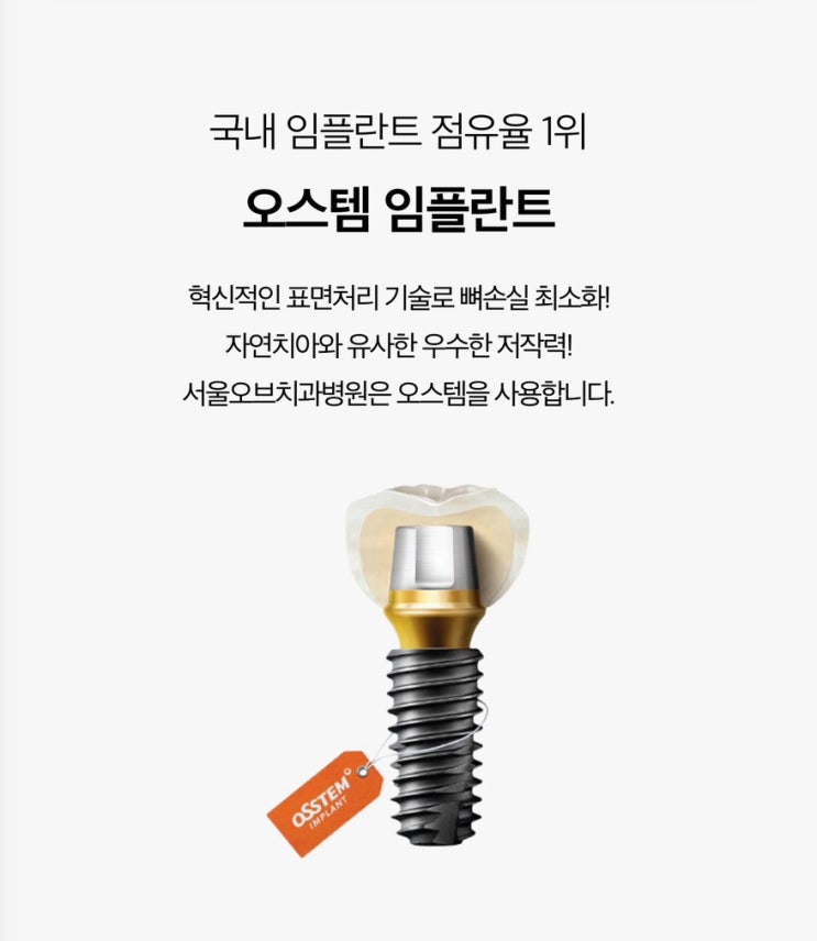  잠실 당일 임플란트를 고민중이라면