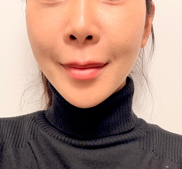  30대 마곡피부과 티타늄리프팅 효과 내돈내산 후기 | 이번주 일상