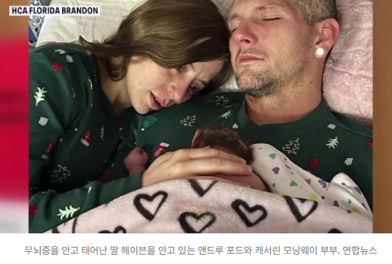   “짧지만 세상에서 가장 아름다웠던 이별” 무뇌증 아기 출산해 장기 기증하고 떠난 부부의 숭고한 선택