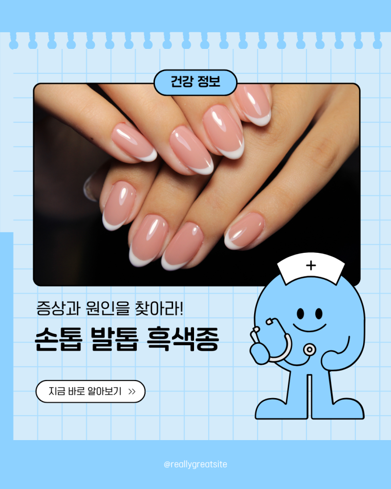 손톱 발톱 흑색종 증상 원인은 무엇이고 치료는?