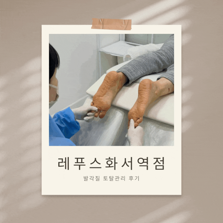  화서발톱무좀·발각질 고민된다면? 50대 여성이 경험한 아기발 변신 과정 [레푸스 화서역점]