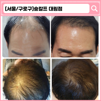 '숲칼프 대림점' 구로 두피관리, 왁싱, 바디관리