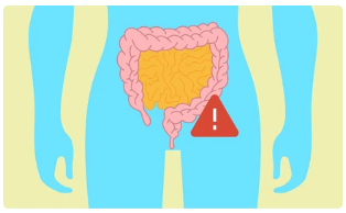  [SCFA분석] 장 건강을 읽는 또 하나의 지표_한국의과학연구원 분석센터