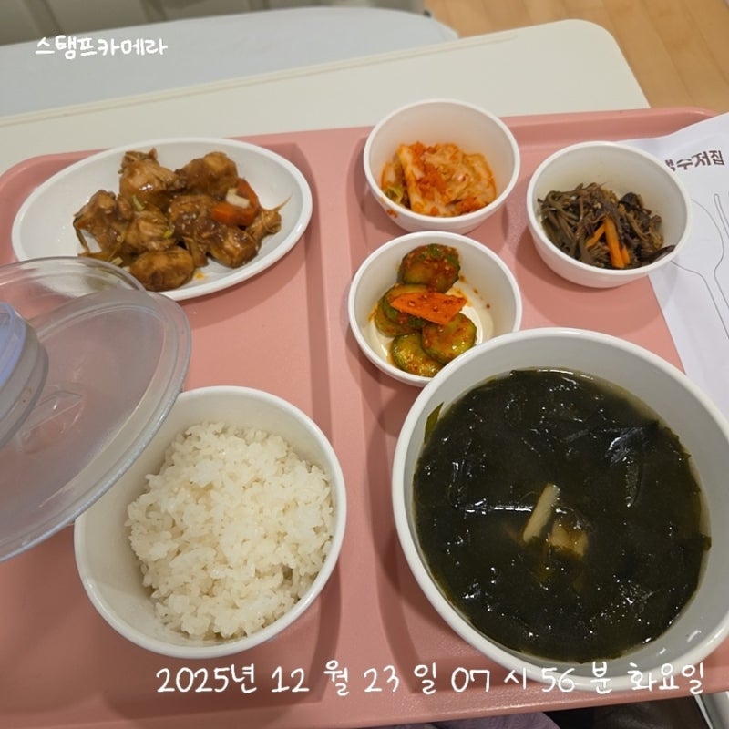 스위치온 다이어트 유지기 43일차 맘모톰 시술 후 회복에 좋은 음식