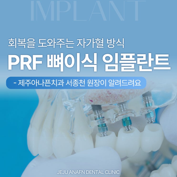  제주이도이동치과 회복을 돕는 자가혈 PRF 뼈이식 임플란트란?