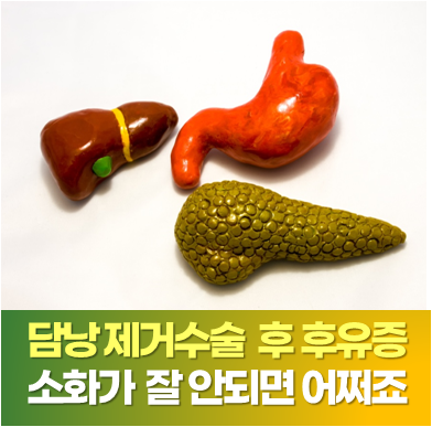 사당 담낭제거수술 후유증 소화가 잘 안 되면 어쩌죠?
