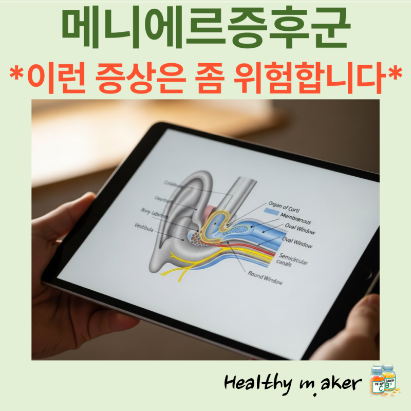 메니에르증후군 원인, 증상, 치료, 수술, 약물, 메니에르병 뜻