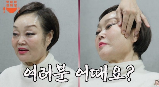   빅마마 이혜정 성형 견적 1200만 원?! 못생겼다는 악플에 수술 결심한 진짜 이유