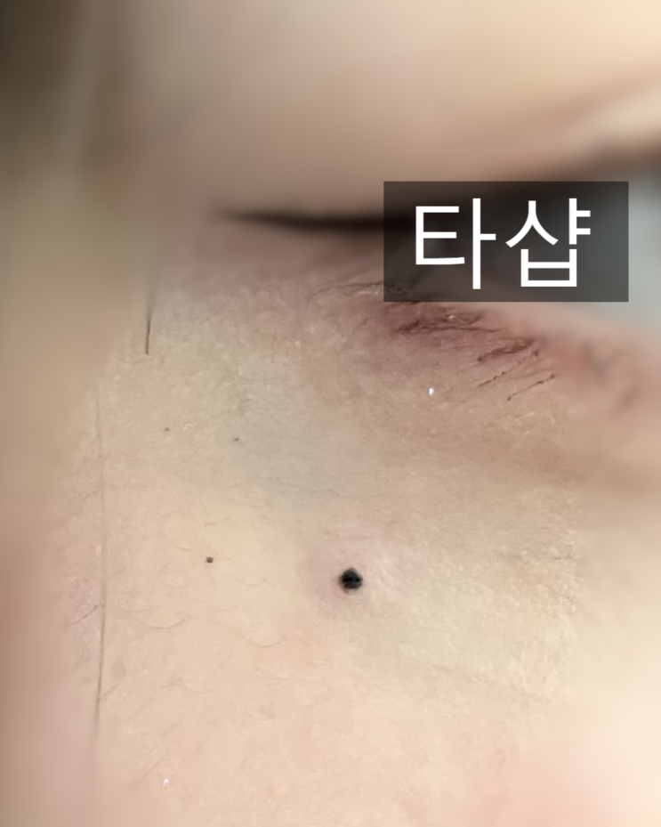  부산 미인점타투 잘하는 곳 고르는 법