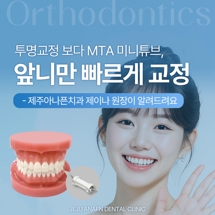  제주교정치과 앞니만 빠르게? 투명교정보다 빠른 MTA 미니튜브 기간